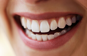 Closeup of smile repaired with tooth-colored crown