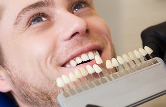 Man’s smile compared with tooth color chart