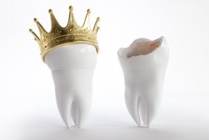 A broken tooth next to a healthy-looking tooth wearing a gold crown