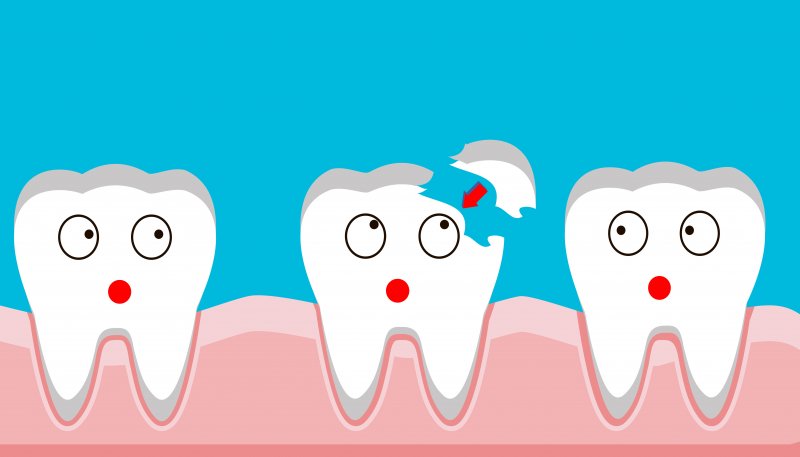 image of chipped tooth in Houston 