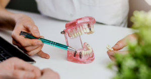 a closeup of a dental implant model